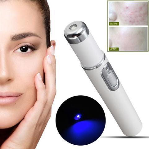 Blue Light Therapy Acne Laser Pen Soft Scar Wrinkle Removal Treatment Device Skin Care Beauty Equipment - Image 10
